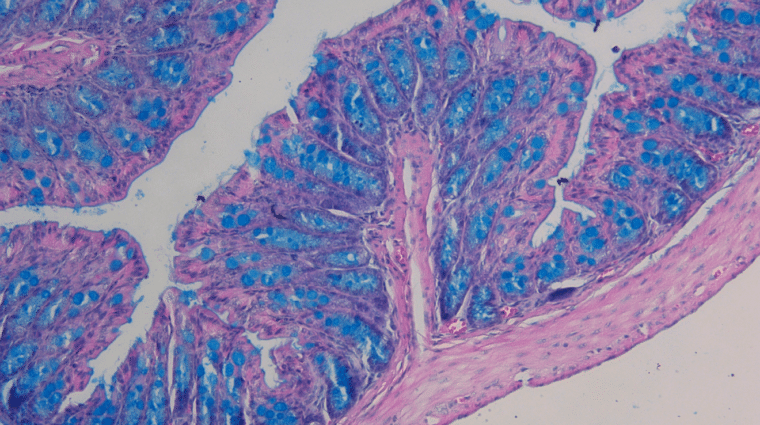 Colitis under a microscope. Blue and pink areas, pink branches, white main branch in the centre.
