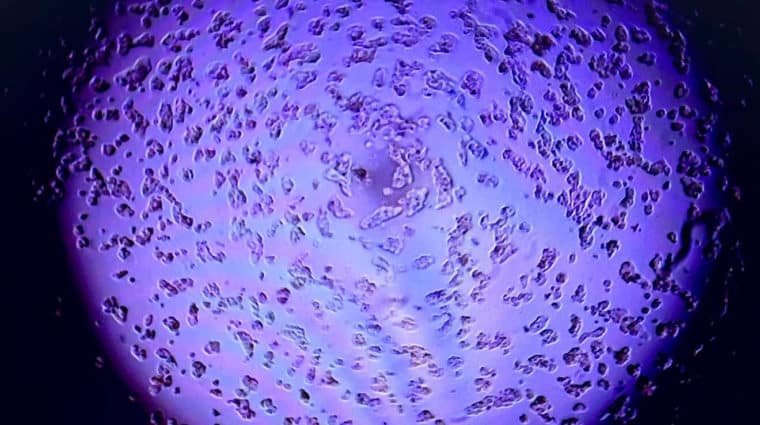 A microscope view of human liver cells exposed to a harmful chemical contaminant. The cells appear irregular in shape