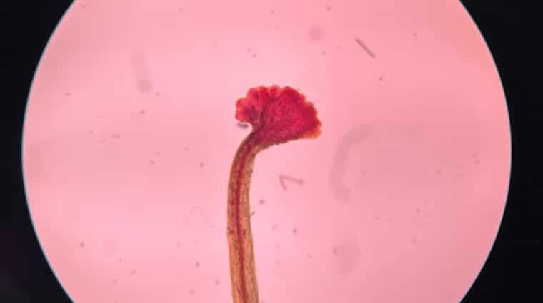 Microscopic view of a Young sporophyte of Fern prothallium