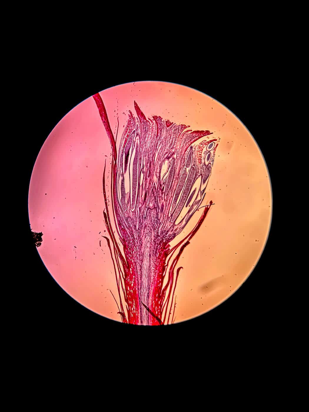 A stained microscopic photo of male moss gametophyte which looks like a beautiful flower.
