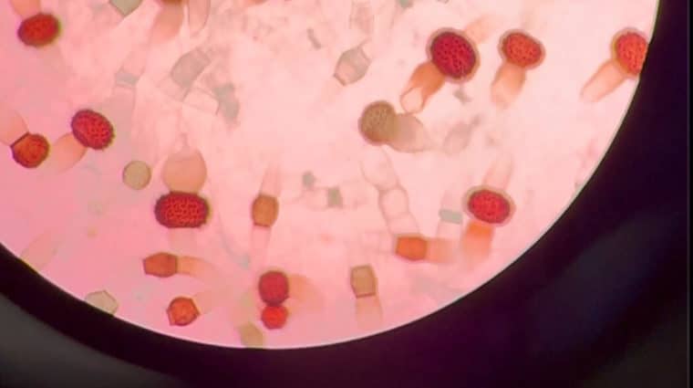 Microscopic image of Rhizopus stolonifera fungi (black bread mold).