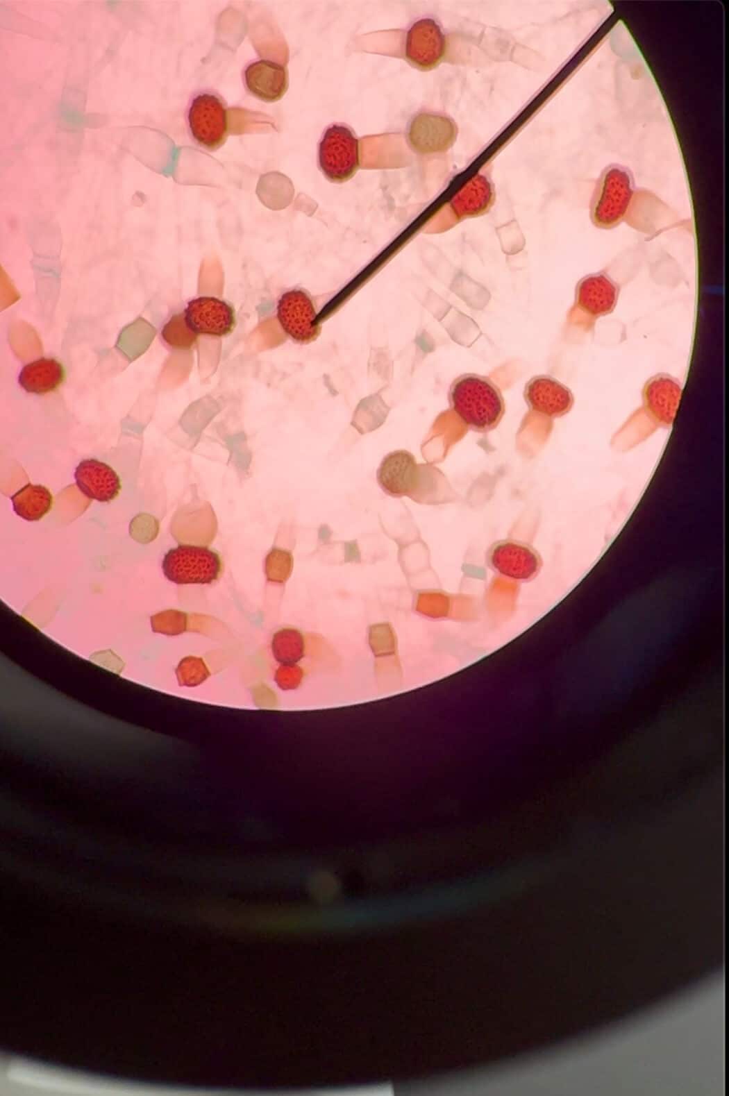 Microscopic image of Rhizopus stolonifera fungi (black bread mold).