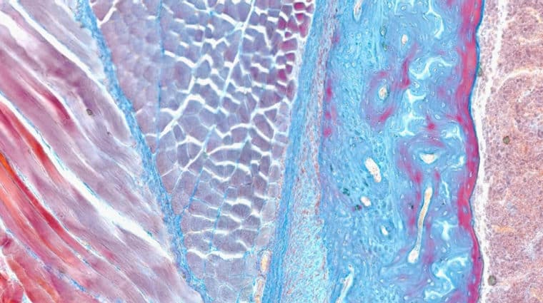 The microscopic image displays a stained section of a joint consisting of connective tissues and bone, which have taken on red, blue, and purple tones.