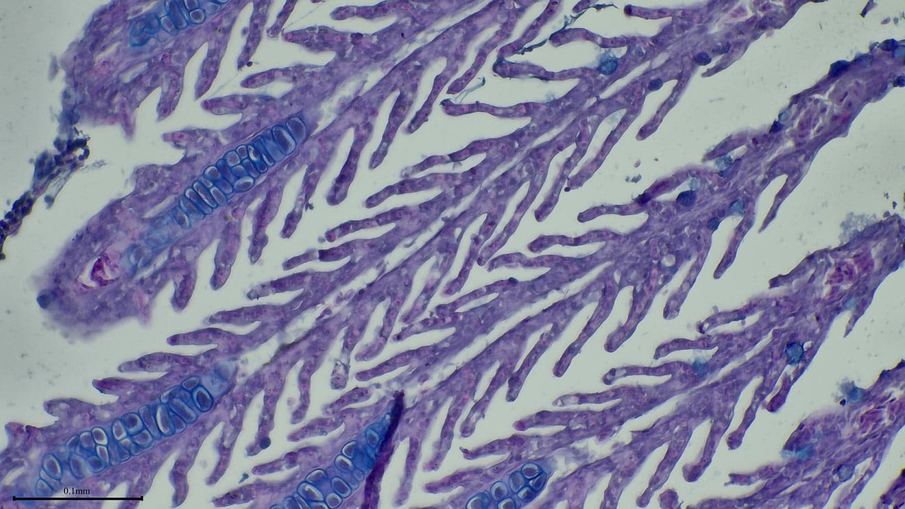 A microscopic image of diagonally arranged, purple-stained tissue with branching finger-like projections and oval, blue cells within the tips.