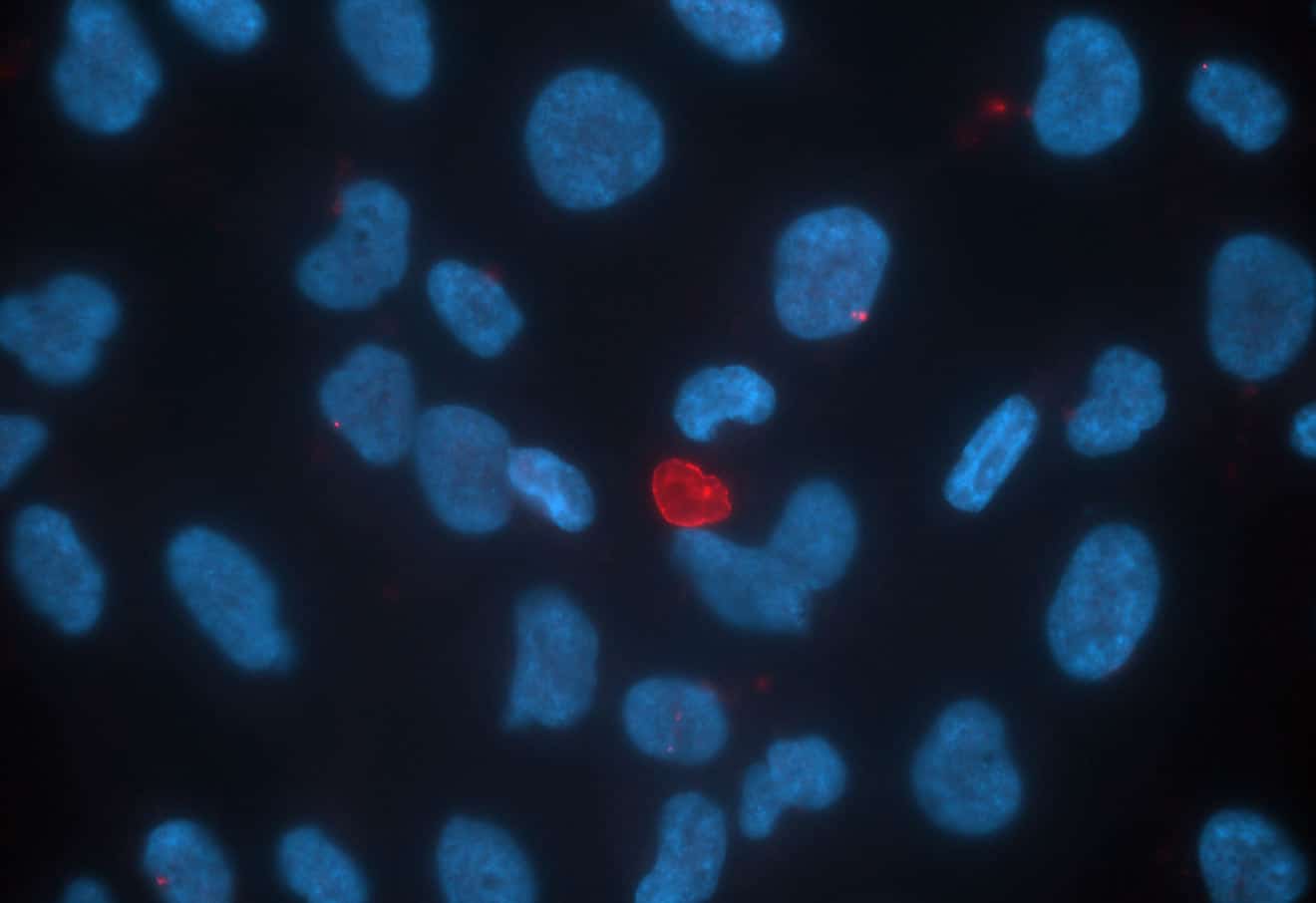 A fluorescence microscopy photo of an irregularly-shaped cellular structure (in red) surrounded by round cell nuclei (in blue), on a black background.